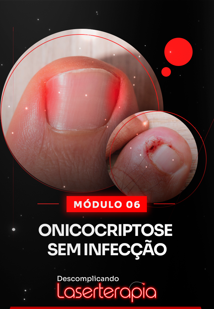 Módulo 06