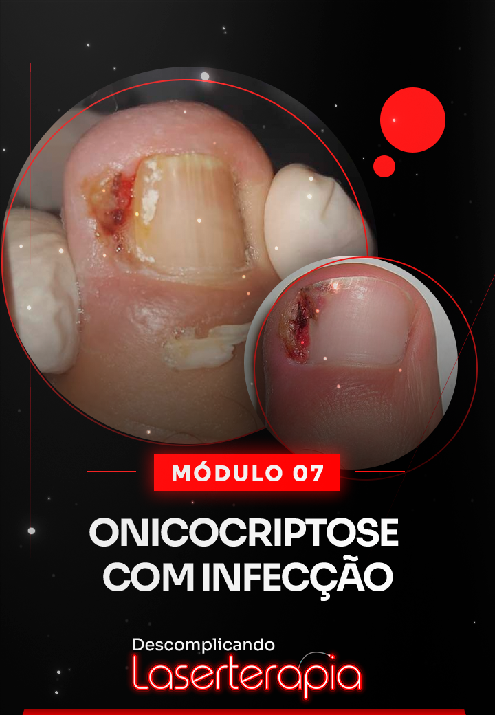 Módulo 07