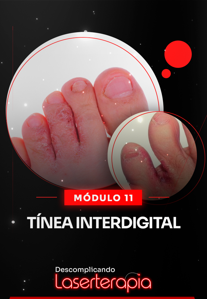 Módulo 11