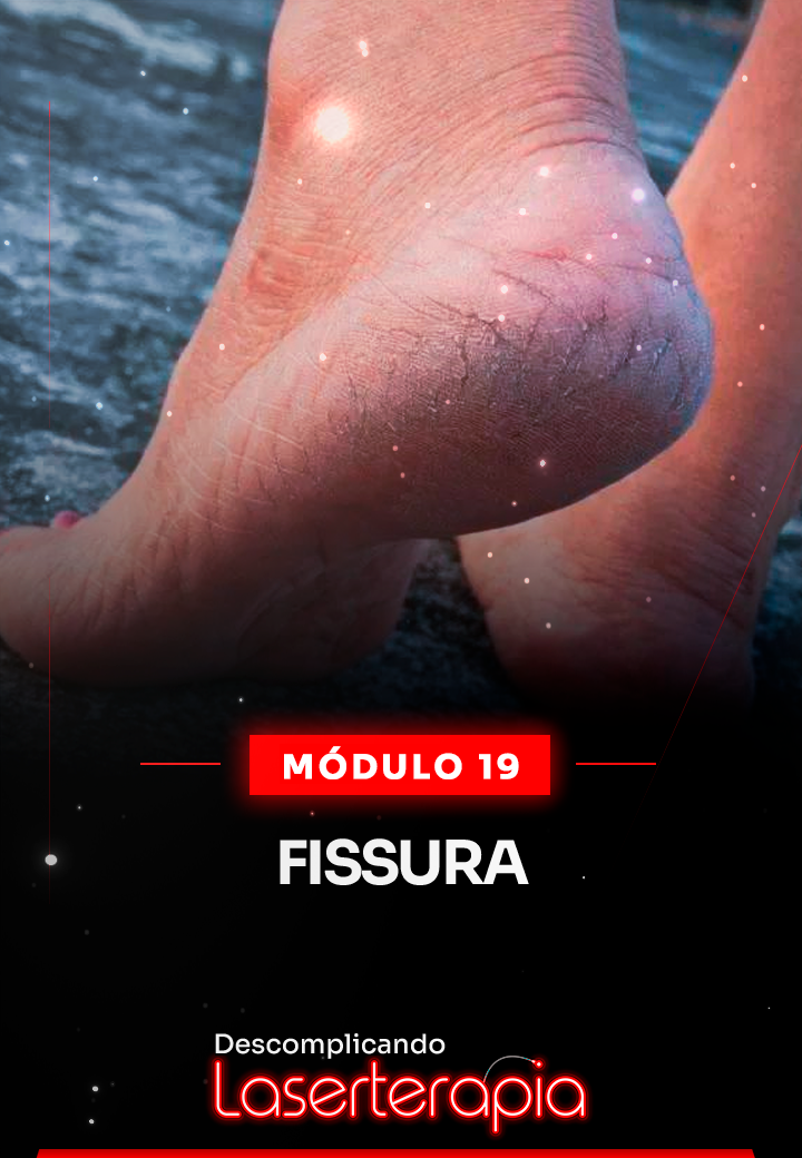Módulo 19