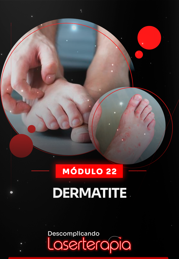 Módulo 22
