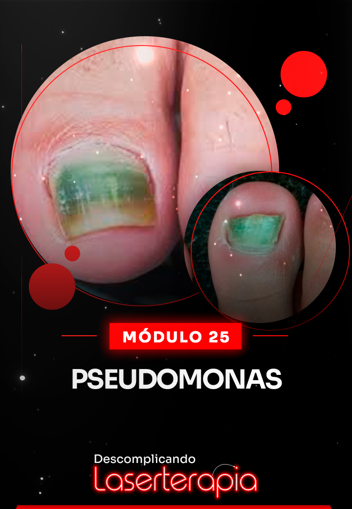 Módulo 25