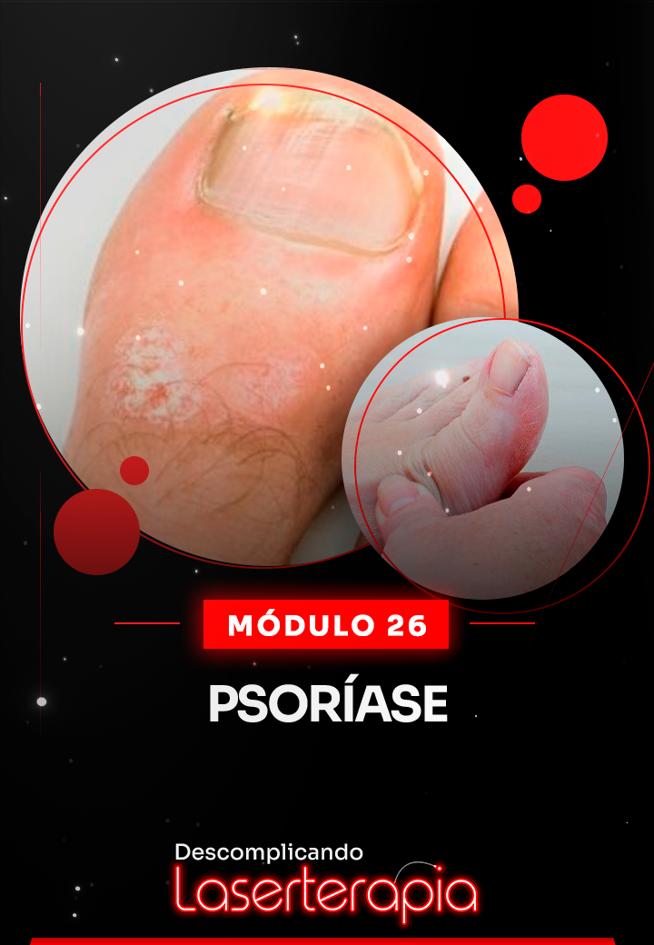 Módulo 26
